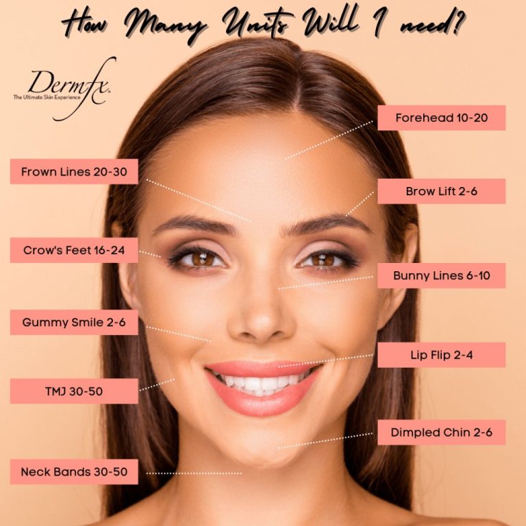 Determining Xeomin Dosage For Forehead: How Many Units Needed