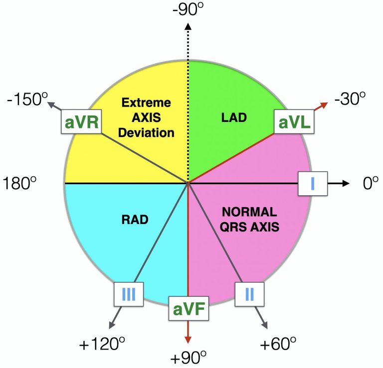 Deciphering The Ecg: How To Determine Axis On Ecg